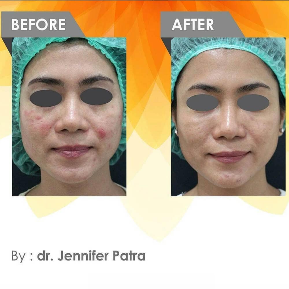 aq-active-serum AQ Active Serum