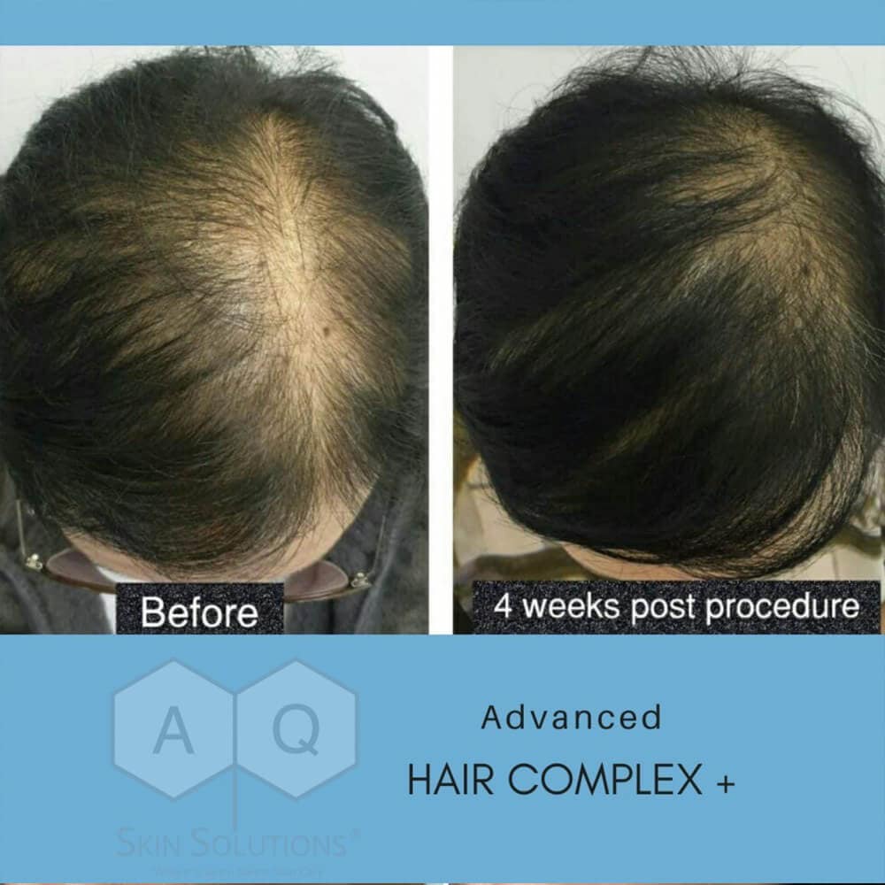 aq-advanced-hair-complex AQ Advanced Hair Complex