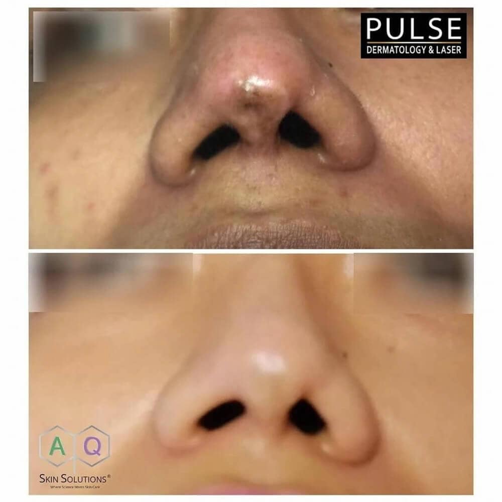 aq-recovery-serum-2 (1)