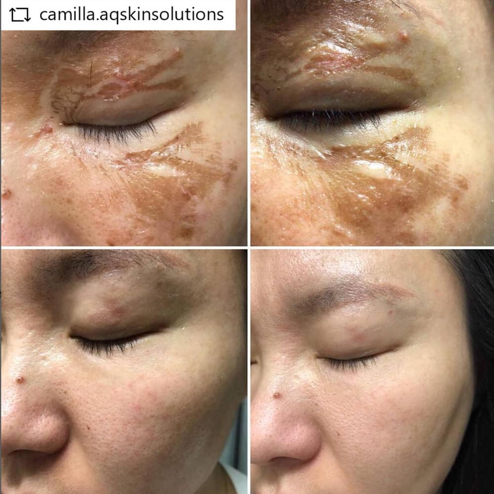 aq- recovery-serum