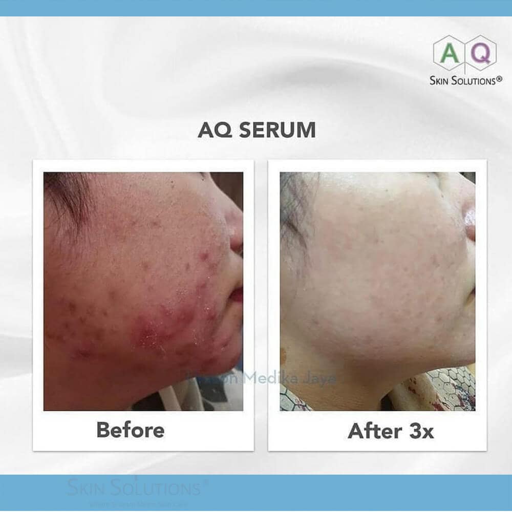 aq-serum- AQ Serum