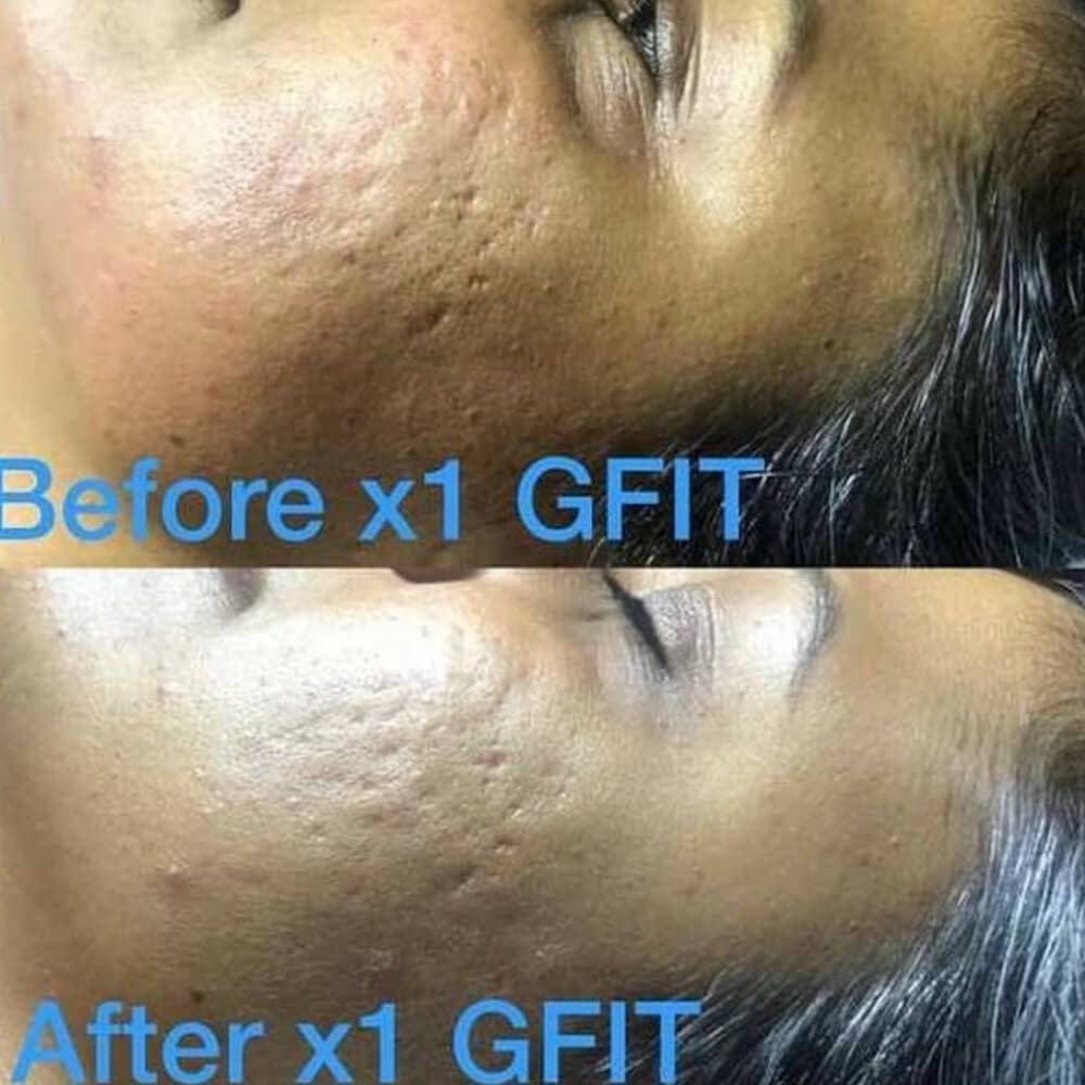 gfit PeptideIT