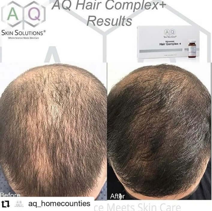 HCmale AQ Advanced Hair Complex