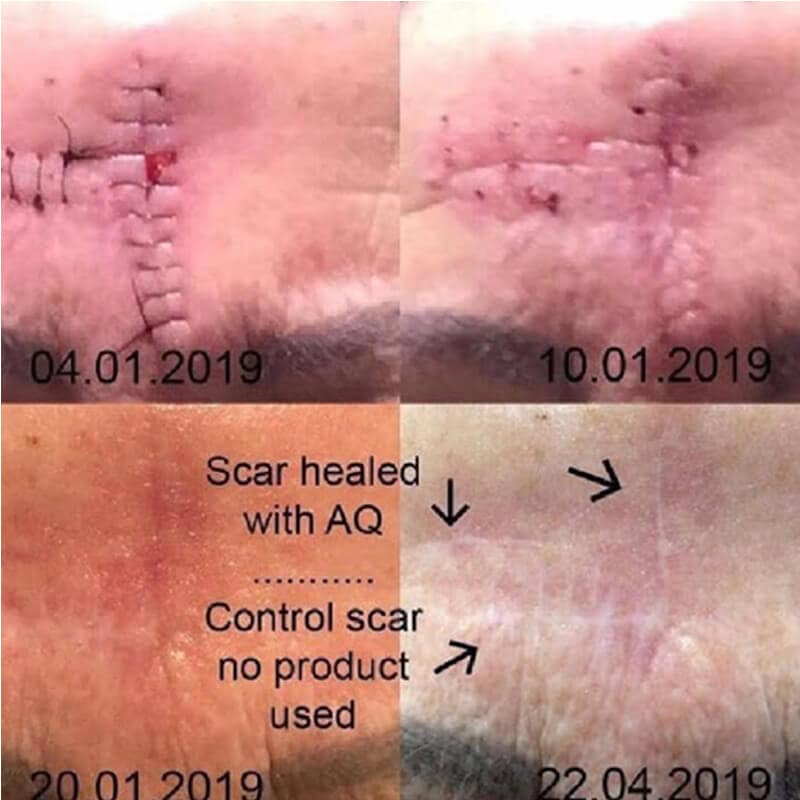 aq-bf-pc (1)